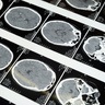 Images from a brain scan