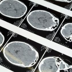 Images from a brain scan