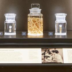 Marina Papaiakovou's display on parasitic worms, featured in the Natural History Museum