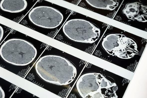 Images from a brain scan